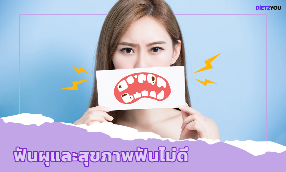 ฟันผุและสุขภาพฟันไม่ดี